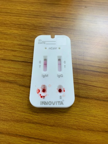 INNOVITA（イノビータ）社のコロナ抗体検査の結果